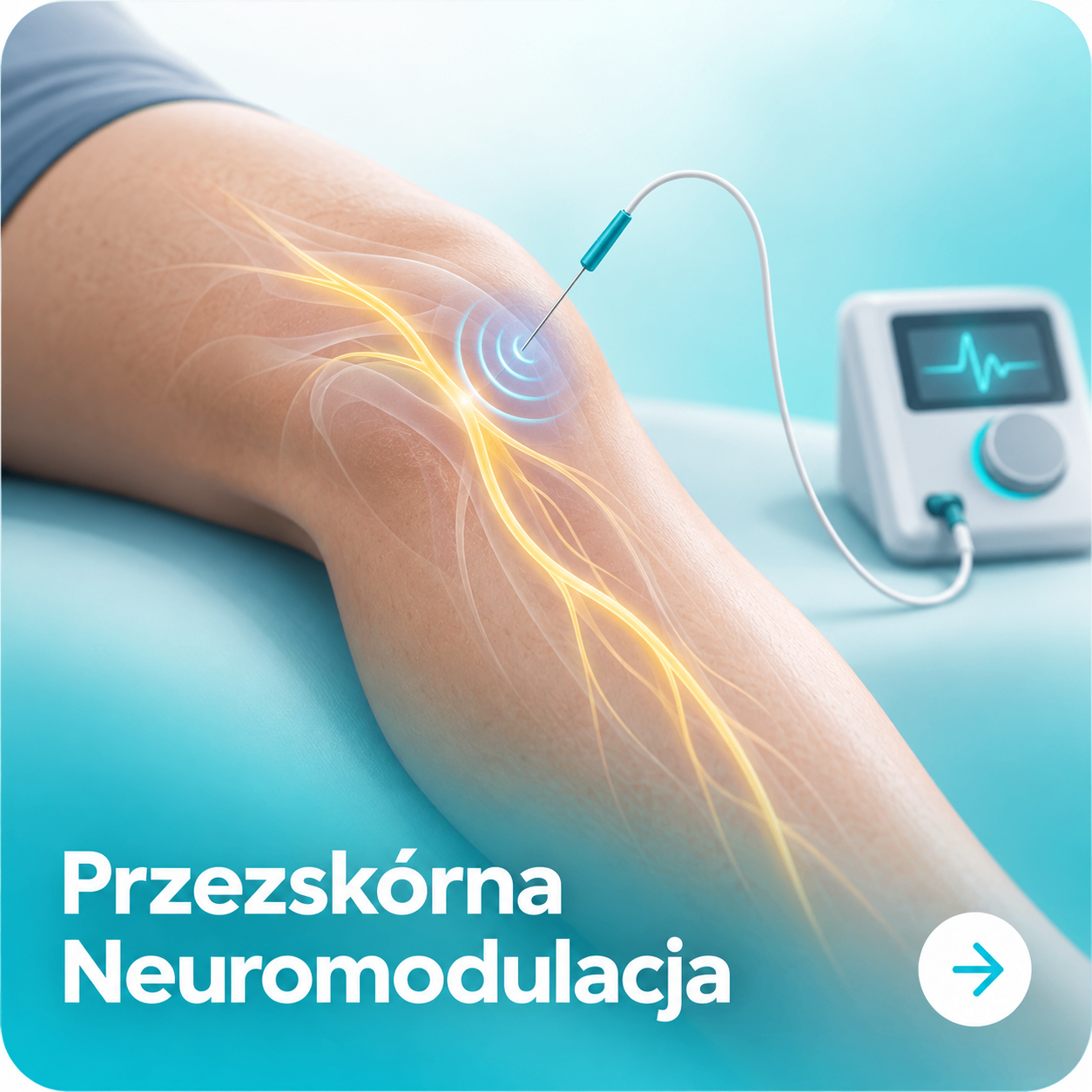 Przezskórna Neuromodulacja